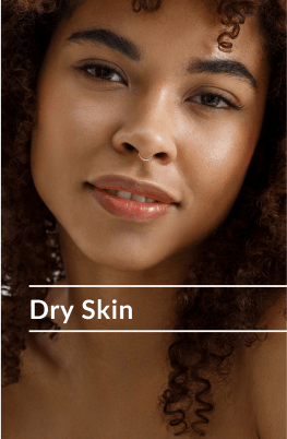dry skin image
