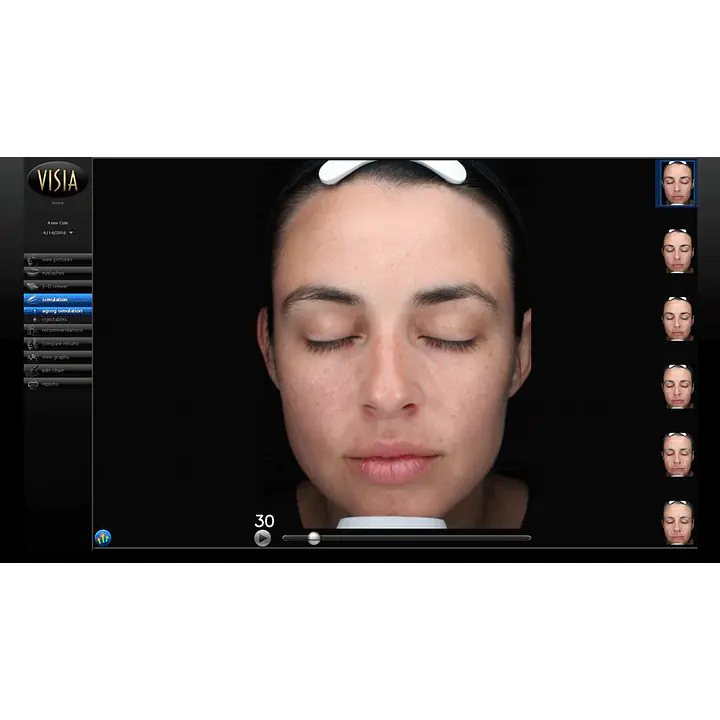 Visia Skin Analysis and In-Person Consultation (Available in Irvine, California) - Master