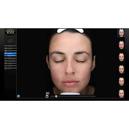 Visia Skin Analysis and In-Person Consultation (Available in Irvine, California) - Master